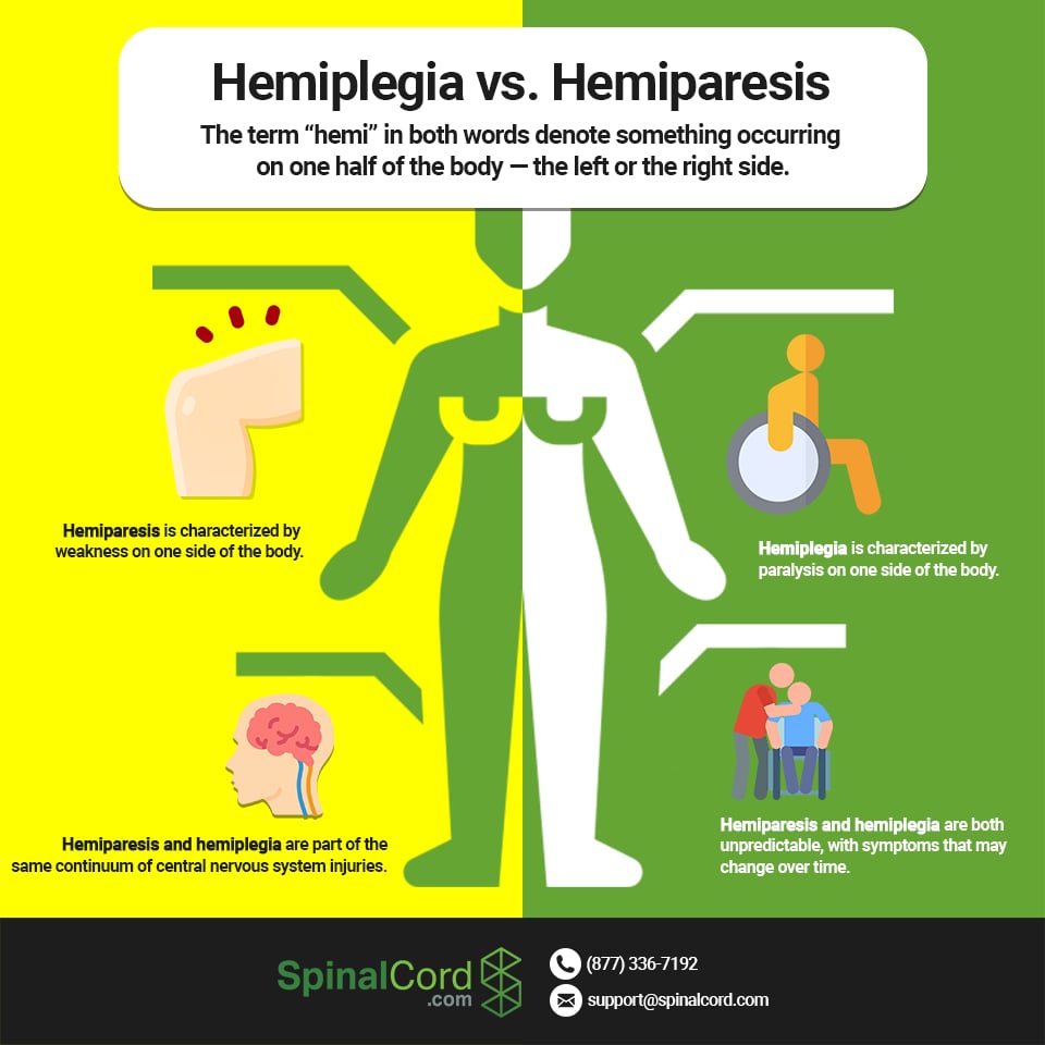 Гемиплегия. Hemiparesis. Гемипарез. Левосторонняя гемиплегия.